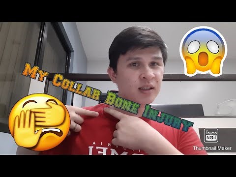 My Collar Bone Injury (Clavicle Fracture)