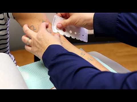 Allergy Skin Testing – Demonstration of Percutaneous (Scratch) and Intradermal Testing