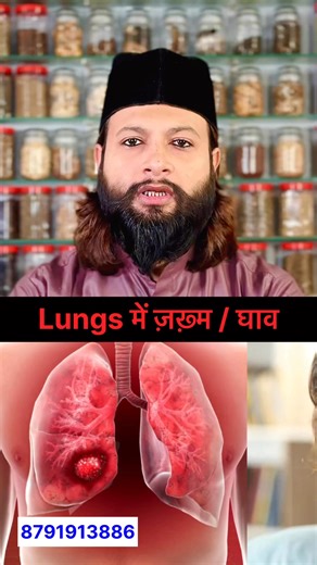 236K views · 5.3K reactions | A powerful home remedy for any kind of lung injury or infection! 贈 Heal and strengthen your lungs naturally — give this trusted remedy a try!  #LungCare #NaturalHealing #HomeRemedy #hakeemaamirqasmi #reels #more #relief #foryou #explore | Hakeem Aamir Qasmi | Facebook