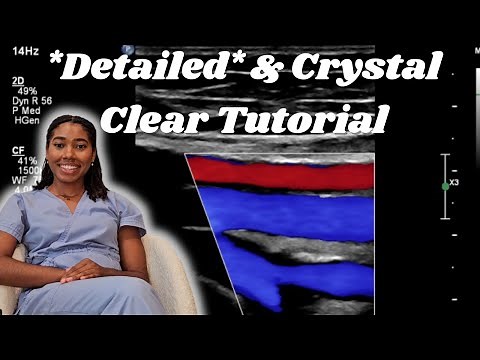 How to Perform Lower Extremity Venous Ultrasounds +Tips for Tricky Patients