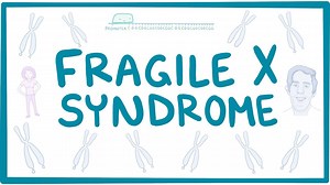 Fragile X syndrome: Video, Causes, & Meaning | Osmosis
