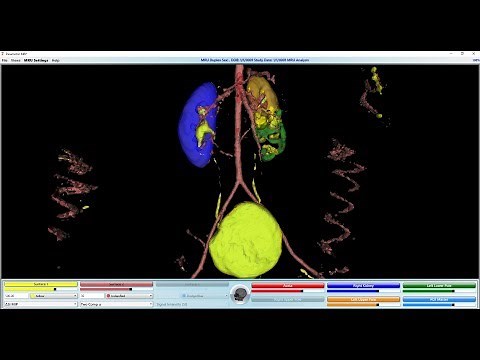 pMRI - How to Analyze an MR Urogram (MRU)
