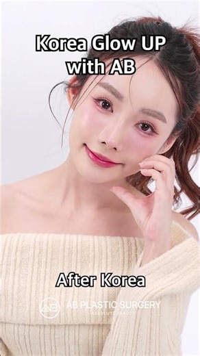 Cheekbone + Brow Lift + Revision Nose: 3-Month Update ✨ #shorts