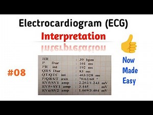 How to Read an ECG (interpretation) | 08 ST-segment