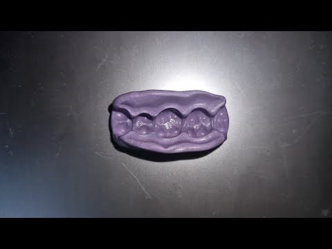 Putty impression Demonstration | Prosthodontics | Dental Occlusion