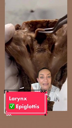 The larynx, also known as the voice box, contains several cartilages that play a crucial role in speech and breathing. Out of the 9 cartilages making up the larynx, 3 are unpaired: the thyroid cartilage, the cricoid cartilage, and the epiglottis. The paired ones are named: arytenoid cartilages, corniculate cartilages, and cuneiform cartilages. The epiglottis is the only laryngeal cartilage made up of elastic cartilage. This is really easy to remember because the epiglottis needs to be elastic en