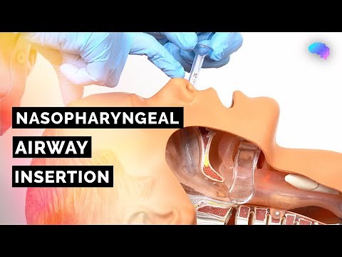 Nasopharyngeal Airway (NPA) Insertion | ABCDE Emergency | OSCE Guide | UKMLA | CPSA | PLAB 2
