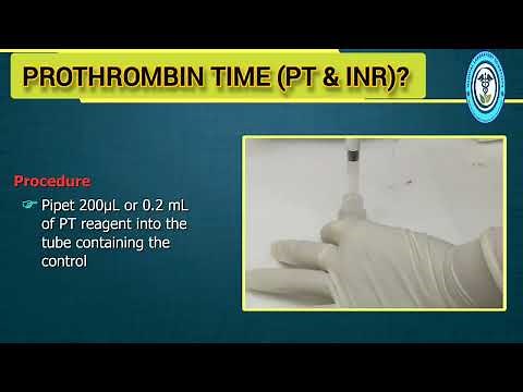 PT (Prothrombin Time) and INR Test Procedure:-
