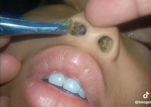 Effective Booger Removal Tips for a Clean Nose