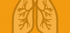 Pleural aspiration (AKA thoracocentesis) - Oxford Medical Education