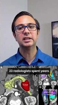 How 145 Hospitals Built AI That Could Transform Cancer Care (PanTS)