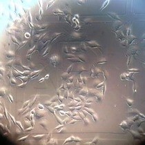 Video: Correlative Light and Electron Microscopy CLEM as a Tool to Visualize Microinjected Molecules and their Eukaryotic Sub-cellular Targets