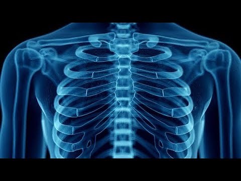 HOW TO READ A CHEST X-RAY?