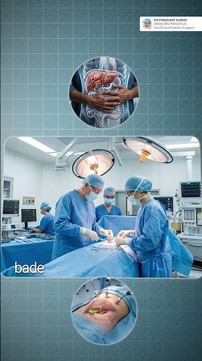 Gallbladder Surgery Explained | Open VS Minimaly Invasive🩺