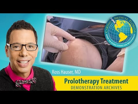 Comprehensive H3 Prolotherapy treatment to a knee- Ross Hauser, MD