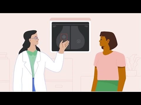 Using artificial intelligence to help detect breast cancer | Google for Health
