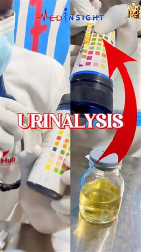 10 Parameter Urinalysis: Performing a Urine Dipstick Test