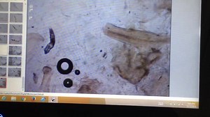 13 shares | How to Search for Demodex Mites! Watch this short video...