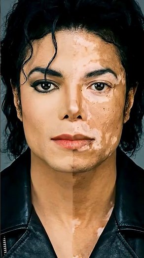 MICHAEL JACKSON NEVER WANTED TO SHOW THIS😔 he suffered from #Vitiligo