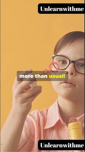 "Understanding Down Syndrome: Causes, Symptoms, and Support"