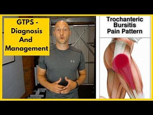 Greater Trochanteric Pain Syndrome Diagnosis and Treatment