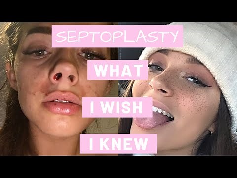 How To Survive A Septoplasty | What I Wish I Knew