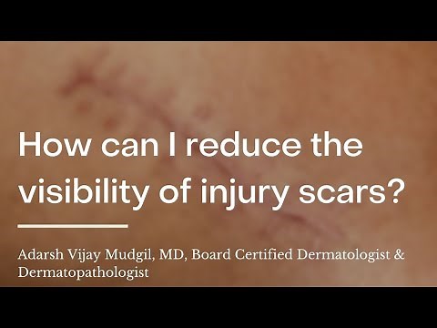 How to Conceal Scars