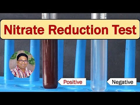 Bacterial identification Tests: Nitrate reduction test