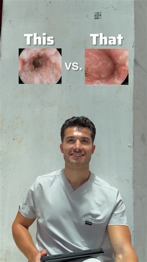 Jacob Portnoff on Instagram: "GI Rapid Fire: This vs That 🔥 Save this for your exams!! #medicalstudent #medicalschool #doctor #usmle #medschool"