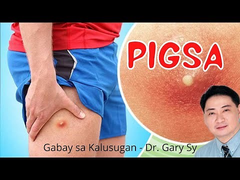 Boil (Furuncle) - Dr. Gary Sy