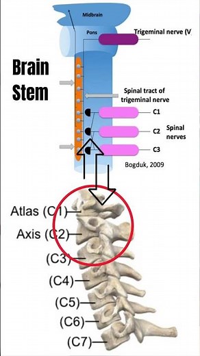 Cervicogenic Headache (Quick Relief l Exercises l Education) #shorts