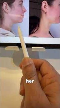 Deep Neck Contouring