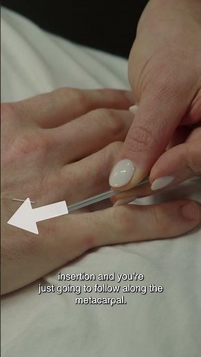 Have You Tried Acupuncture To Help Treat Arthritis?