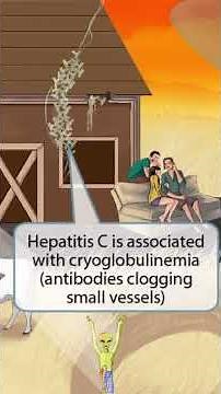 Hepatitis C Virus — Understand the path, and the questions become easy