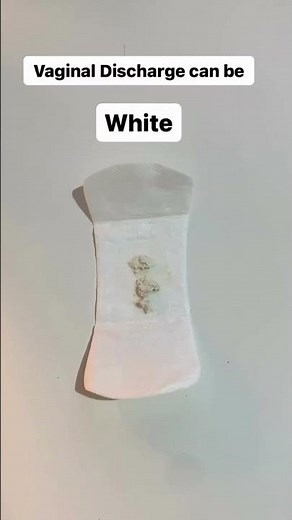 Understanding Your Vaginal Discharge