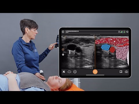Clarius T-Mode™ for Head & Neck