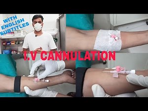 Intravenous Cannulation Technique | Iv Cannulation Procedure