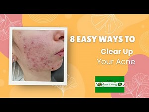 Say Goodbye to Acne: 8 Powerful Ways to Clear Acne Scars for Good!