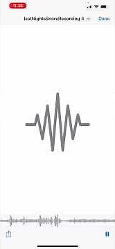 Listen to a normal snore versus a sleep apnea snore