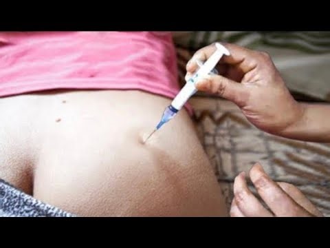 Intramuscular Injection in Gluteal Muscle | Safe Hip IM Injection Technique Step-by-Step Guide