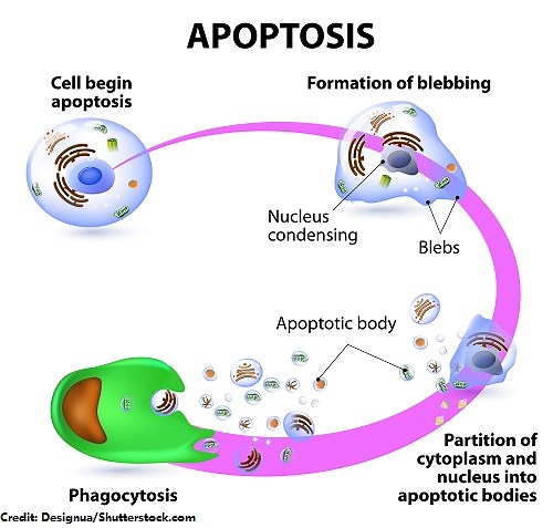 Systemic Lupus Erythematosus (SLE) Nursing NCLEX Review