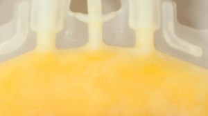 The Secrets of Cryoprecipitate: A Blood Banking Process - Insights