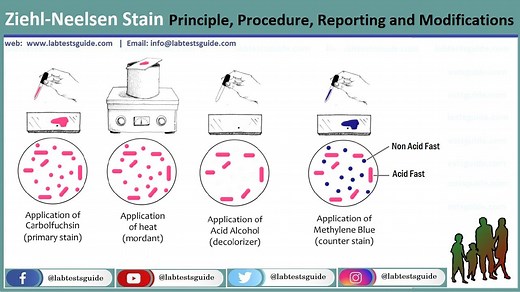 Z.N Stain (Ziehl-Neelsen Stain) | Lab Tests Guide