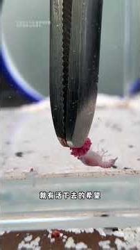 The story of a strong little shrimp...#Everything Is Lovely Plan#365 Little Things about m