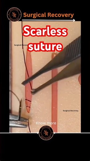 Scarless suture #mbbs #mbbsabroad #mbbsmotivation #neetmotivation #neetug #pw_motivation #pwians #yt