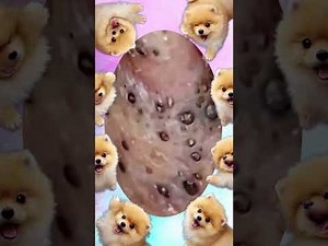 Blackheads Removal | Acne Treatment and Very Satisfying Satisfying Pimple pop #blackheads