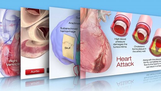 Cardiovascular Disease and Diabetes