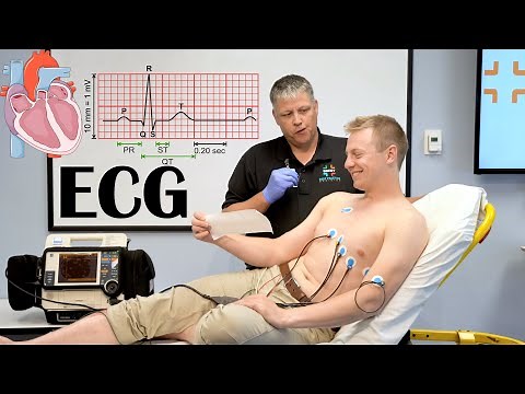 What Is ECG (Electrocardiogram/EKG) |Indications, How It Is Done? And Basic Principles