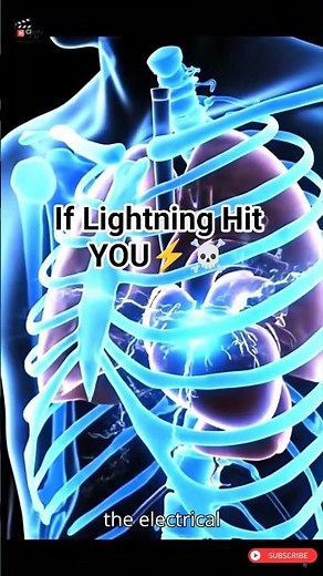 What Happens When Lightning Hits a Human Body🔥🌩