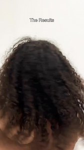 386 reactions · 11 comments | Hair thinning, alopecia, or frizzy, dry...